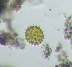 Pseudopediastrum boryanum longicorne