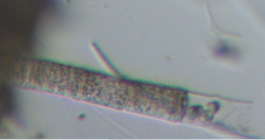Microspora floccosa