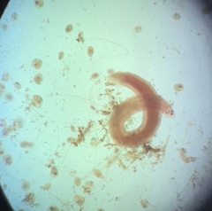 Prostoma