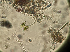 Staurastrum polymorphum