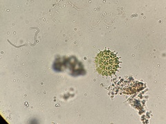 Pseudopediastrum boryanum longicorne