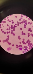 Babesia canis