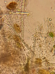 Cocconeis
