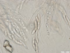 Echinosphaeria strigosa