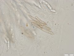 Echinosphaeria strigosa