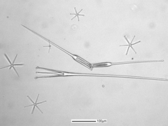 Pinulasma