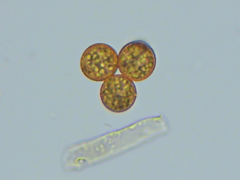 Botryobasidium simile