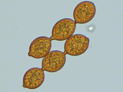 Botryobasidium simile