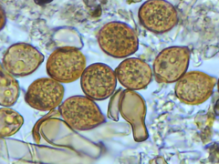 Botryobasidium simile