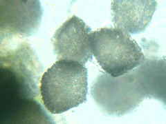 Anthoceros macounii