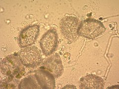 Anthoceros macounii