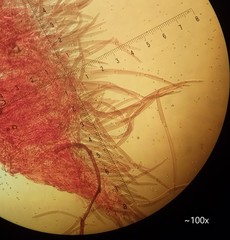 Pluteus microspermus