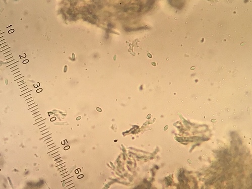 Chaenothecopsis savonica image