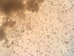 Chaenotheca stemonea