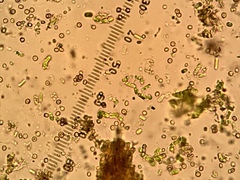 Chaenotheca stemonea