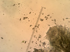 Chaenothecopsis dolichocephala