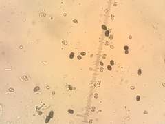 Calicium lenticulare