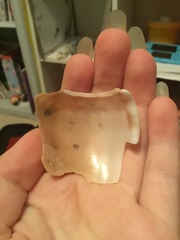 Phalium bandatum