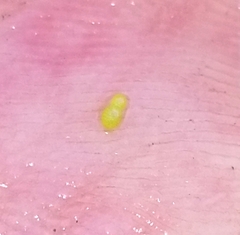 Wolffia brasiliensis