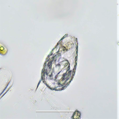 Euglypha acanthophora