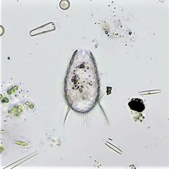 Euglypha acanthophora