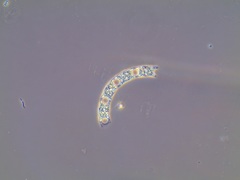 Eucampia zodiacus