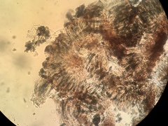 Mycocalicium subtile