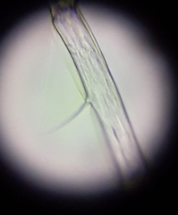 Eucyclops serrulatus