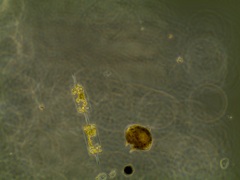 Protoperidinium
