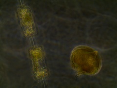 Protoperidinium