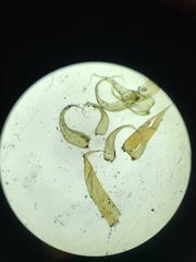 Brotherella recurvans