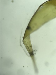 Brotherella recurvans