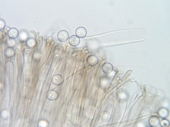 Pseudoplectania melaena
