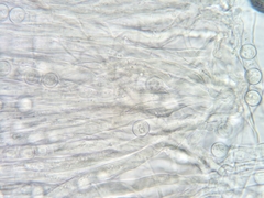 Pseudoplectania melaena