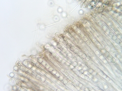 Pseudoplectania melaena