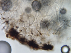 Pseudoplectania melaena