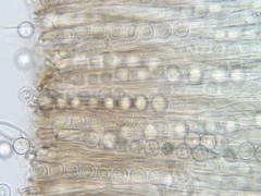 Pseudoplectania melaena