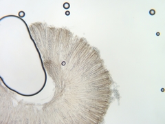Pseudoplectania melaena