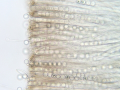Pseudoplectania melaena
