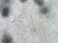 Pseudoplectania melaena