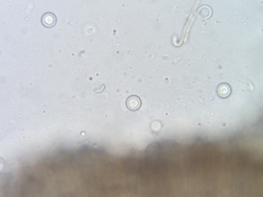 Pseudoplectania melaena