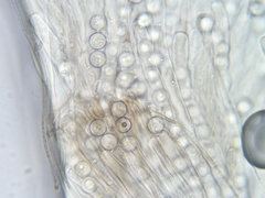 Pseudoplectania melaena