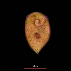 Stentor amethystinus