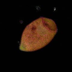 Stentor amethystinus