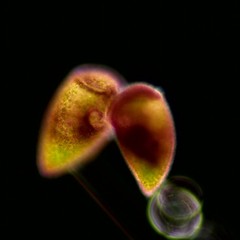 Stentor amethystinus