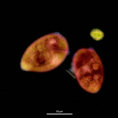 Stentor amethystinus