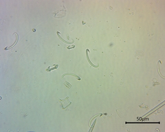 Coelosphaeridae