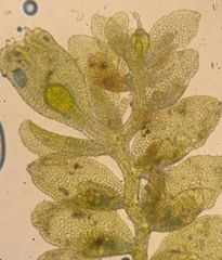 Siphonolejeunea olgae