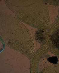 Siphonolejeunea olgae