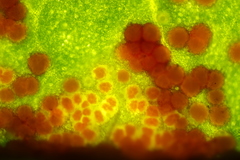 Synchytrium taraxaci